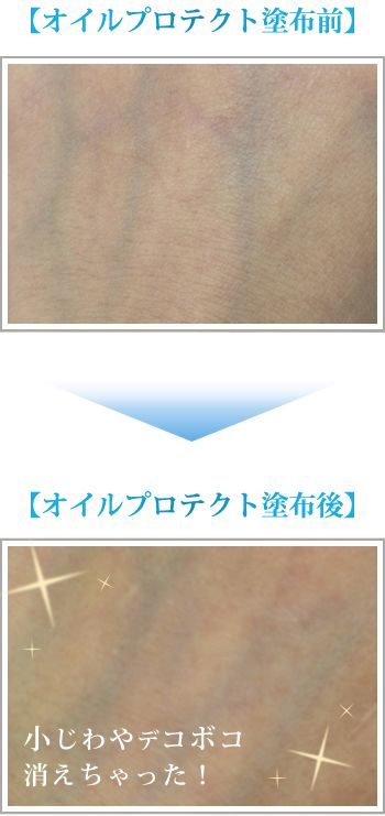 小じわやデコボコ消えちゃった!